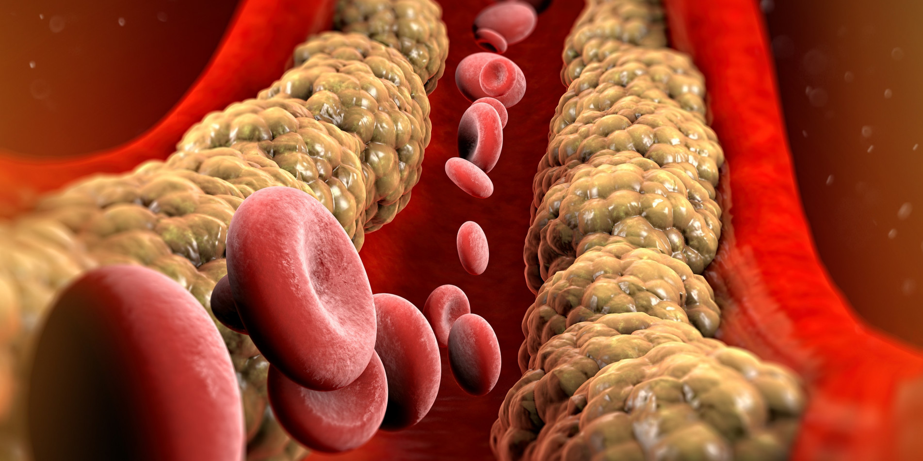 A diminuição é considerada importante por especialistas, já que níveis elevados de colesterol estão entre os principais fatores de risco associados às doenças cardiovasculares