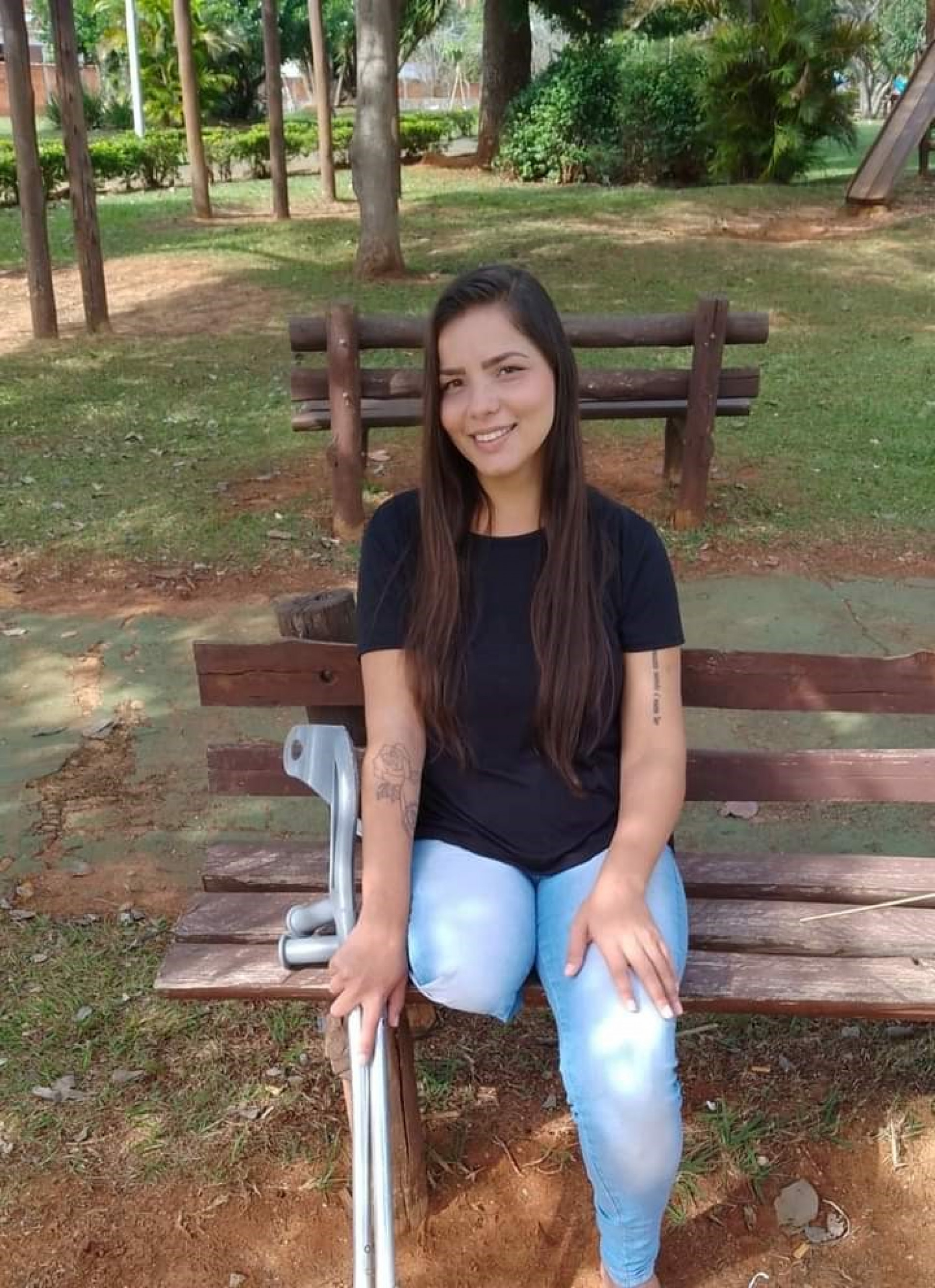 Samara Martins de Oliveira, de 24 anos, sofreu um acidente há dois anos e teve a perna direita amputada